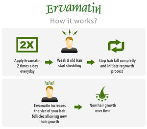 Ervamatin Hair Lotion | Natural Hair Loss Treatment